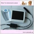 The Top Qualityatnl51353A Full-Digital Portable Ultrasound Scanner for Human Use and Vet Use